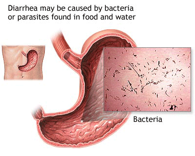 Diarrhea Bacteria