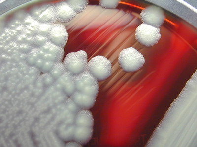 Bacillus Cereus image by en.wikipedia