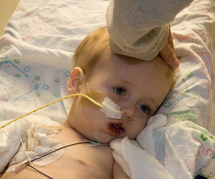 leukemia symptoms leukemia symptoms