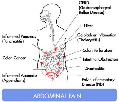 Abdominal pain