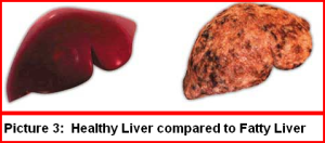 picture3 healthy vs fatty liver