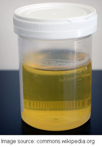 urine sample