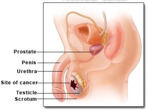 testicular cancer photos pictures