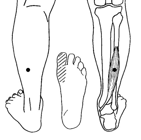 Numbness In Big Toe