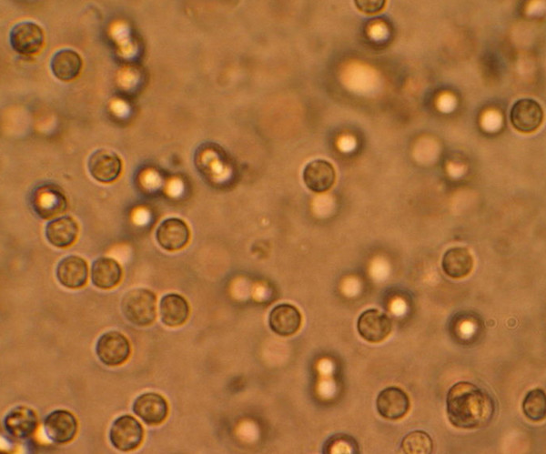 pyuria microscopic examination