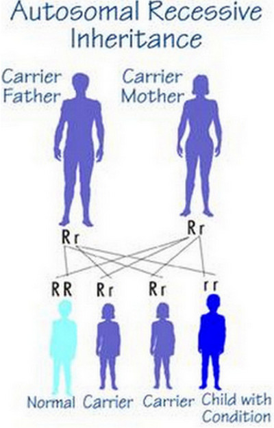 hurler syndrome inheritance chart