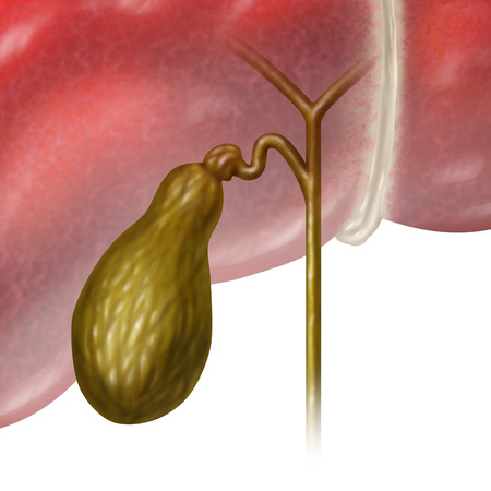Gallbladder Removal