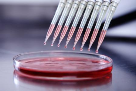 genetic screening pregnancy Genetic Screening Pregnancy