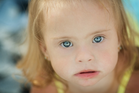 Cheerful little girl with down syndrome