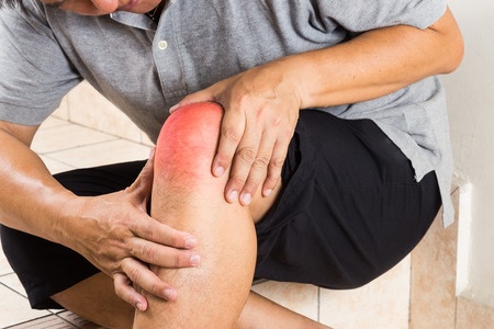 Arthritis Symptoms