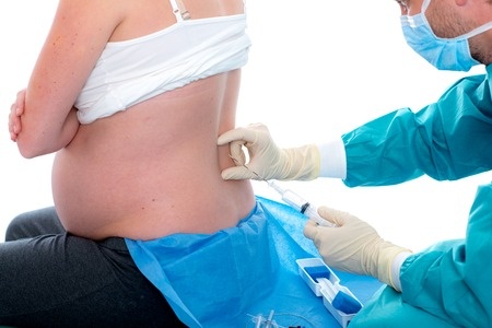 34 Weeks Pregnant Epidural