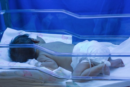Newborn Premature Baby Jaundice
