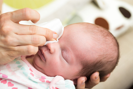 Baby Acne Remedies