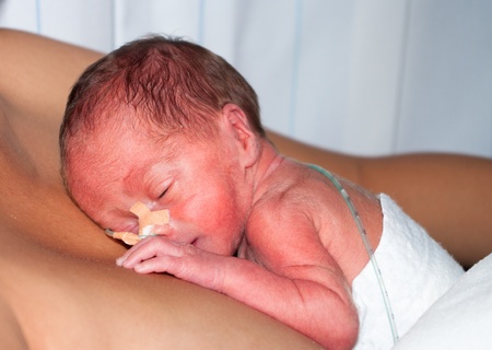 Premature Baby in NICU
