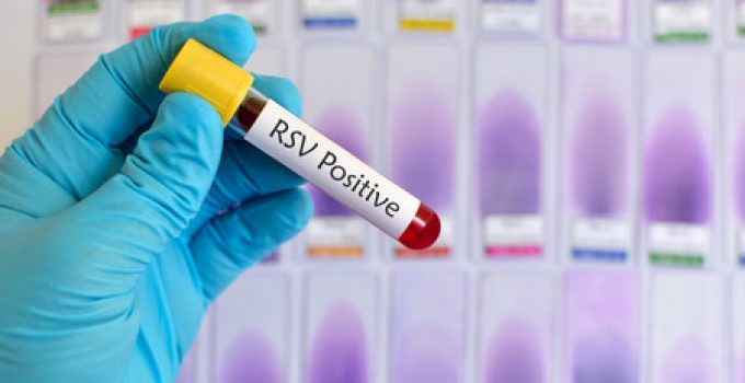 RSV