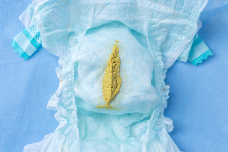 Normal Baby Poop