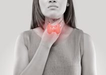 Hypothyroidism