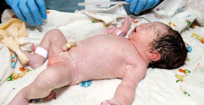 Newborn Baby Screening Test