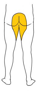 Area of saddle anesthesia